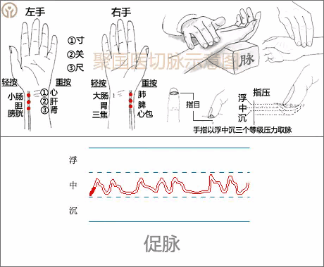 High-definition pulse diagnosis and meridian charts in Traditional Chinese Medicine